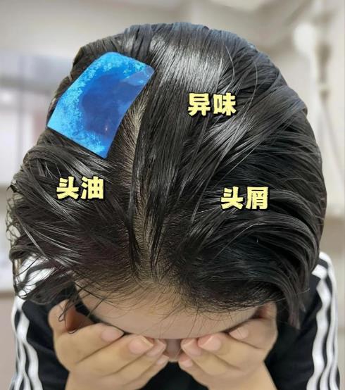 Oily hair and dandruff? It's not that you didn't wash it clean—it's that your scalp is out of balance