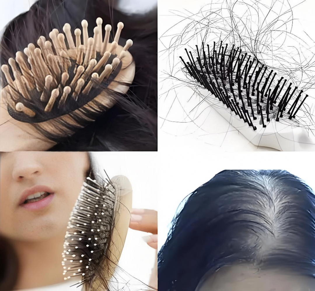 Can seborrheic hair loss grow back? Singapore hair loss clinic: examine first, then plan